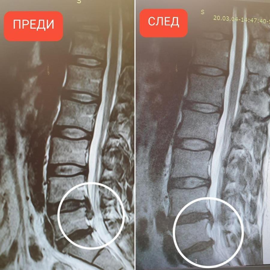 Hotel-Clinic Dr. Gechevi Pavel Banya Dış mekan fotoğraf